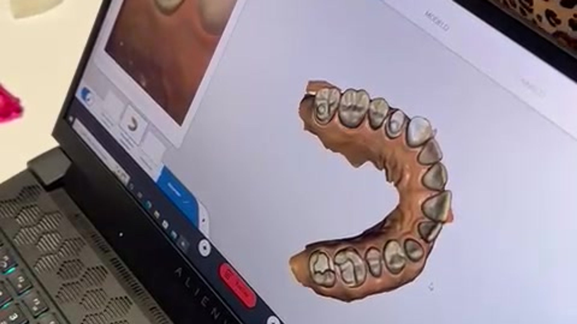 Treinamento de Escaneamento InoviLab